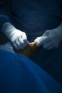 整形无创医院急诊骨科和创伤外科手术室医疗诊所真实生活照片在足踝和腿关节背景