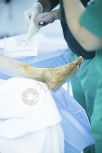 医院急诊骨科和创伤外科手术室医疗诊所真实生活照片在足踝和腿关节图片
