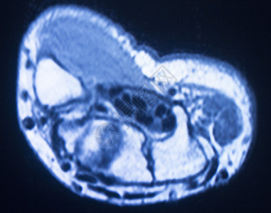 手和指的医学扫描试验结果显示图片