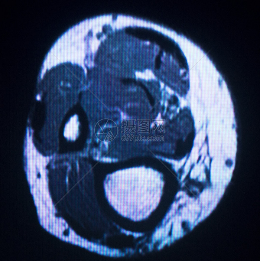磁共振成像医学扫描测试结果显示图片