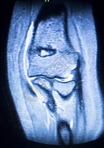 磁共振成像医学扫描测试肘部检查结果显示图片