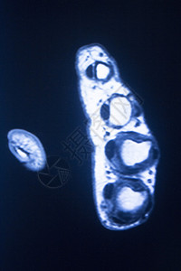 手和指的医学扫描试验结果显示图片