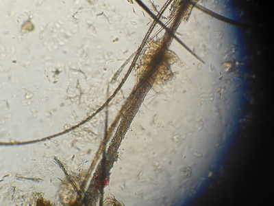 霉菌性阴道炎一只显微镜猫的毛发被损坏了皮肤受精微粒罐子增背景