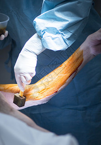 医院手肘术紧急矫形手动术图片