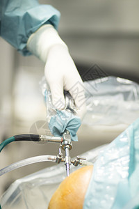 膝盖紧急手术室照片中被撕伤的脑膜外科手术图片