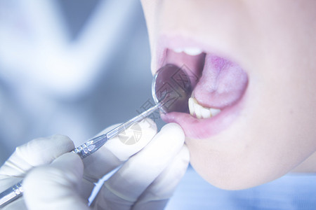 在牙科检查中检查病人的口腔图片