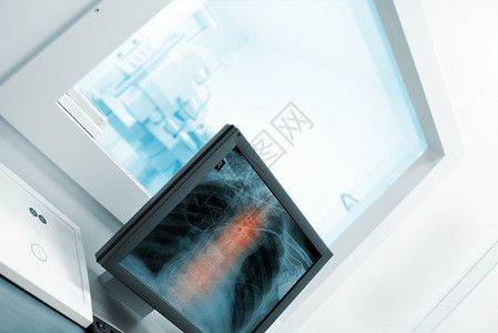 医院X光柜中的计算机图片