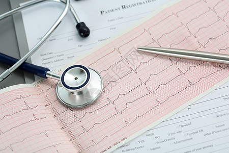 听诊器头和银笔躺在剪贴板垫上的心电图上心脏治疗师协助医生制作心脏生理脉搏测量文件心律失常理念背景图片