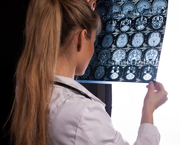 一位身穿白色实验室衣的女医生的后视镜透过脑部微米看人脑图片