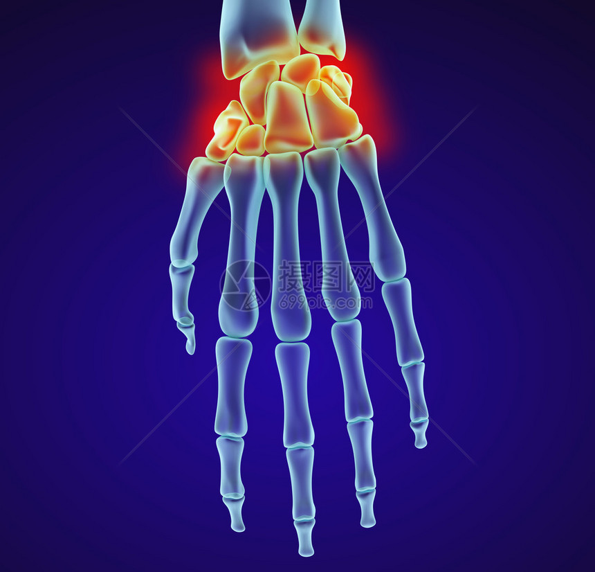 人体手腕解剖X光视图医学精图片