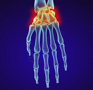 人体手腕解剖X光视图医学精图片