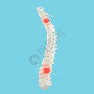 人类脊椎模型背景图片