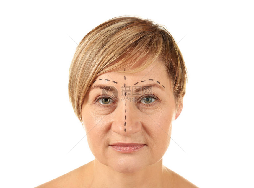 整形手术脸上有印记的女人图片