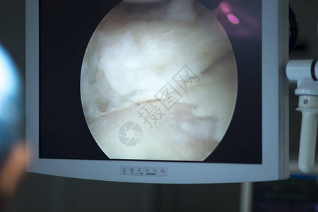 剖面外科手术屏幕图片
