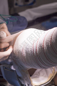 骨科医院手术室急诊室手术膝关节镜显微手术后的护士包扎图片