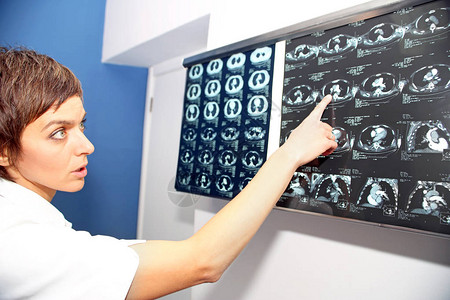 医生查看肺部计算机断层扫描图像图片