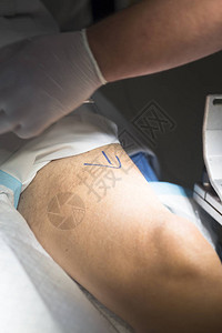 在手术室的病人腿部在医院急诊室外科手术图片