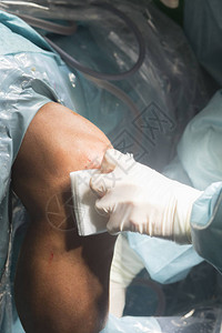急诊室手术室膝关节手术医院手术医疗程序图片