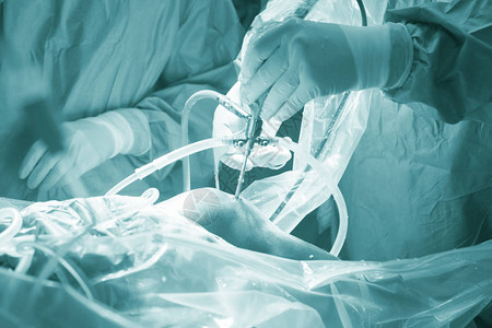 急诊室手术室膝关节锁孔手术医院关节镜图片