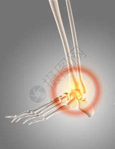 3D骨架骼折脚踝图片