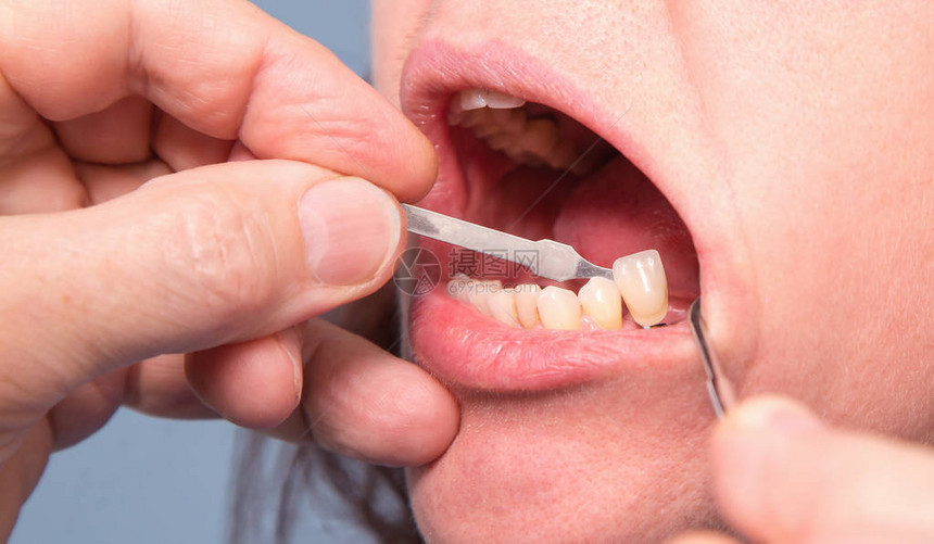 牙科医生检查和选择妇女牙齿图片