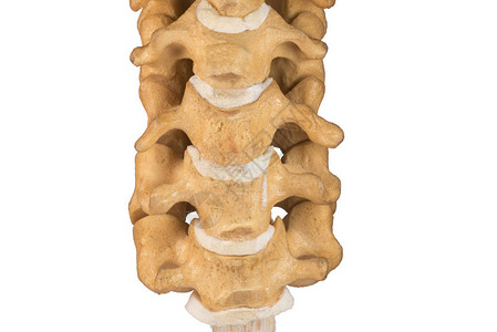 人造颈椎下颈椎特写背景图片