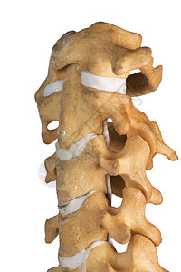 人造颈椎斜视上脊柱水平特写图片