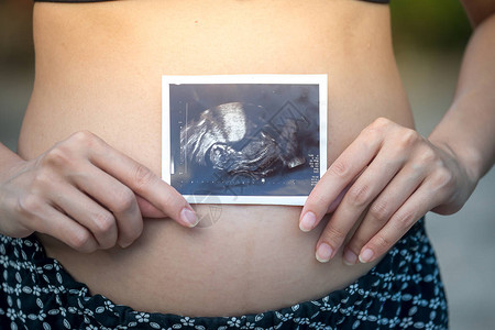 孕妇在她的肚子上进行超声波扫描捕获的特写镜头图片