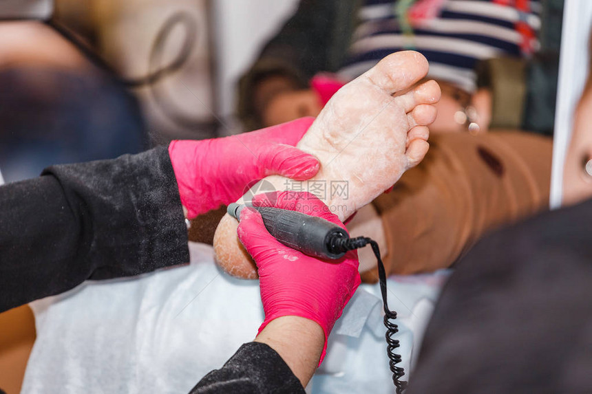 修脚专家执行清洁脚部和客户脚后跟问题皮肤的程序