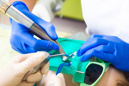 一位身穿医用制服和无菌手套的女牙医和她的助手用牙菌斑钻擦亮牙齿背景图片