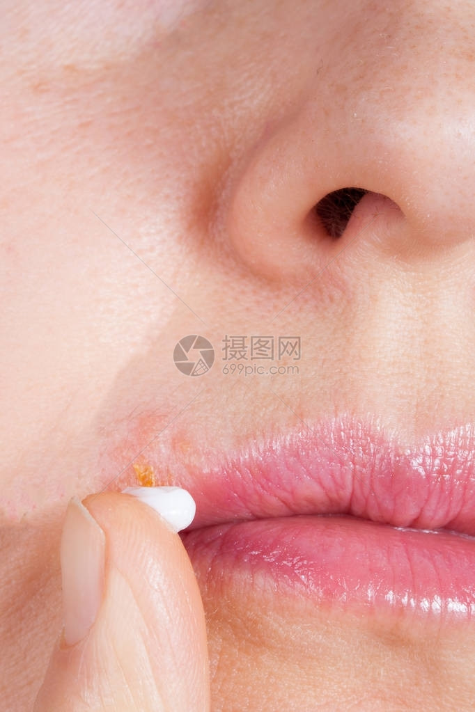 嘴唇缝合的巨型疹女润滑剂给宫图片