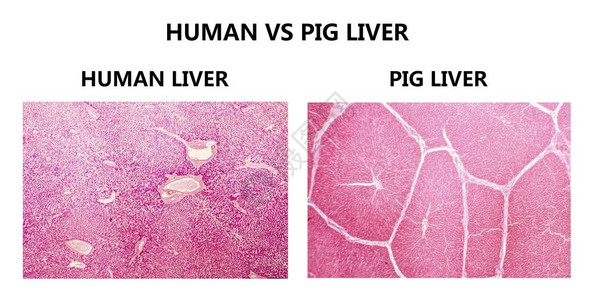 人和猪肝组织学图片