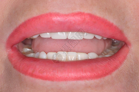 牙科诊所病人嘴巴的特写图片