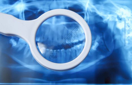 近距离看一眼牙齿结构的X光图图片