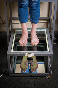 步进数字尺扫描矫形足部扫描定做鞋垫姿势和平衡分析医生病人图片