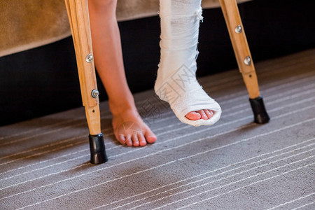 腿断了成了无法辨认的小石膏孩子年轻骨科女孩在家里拄着拐杖拐杖断腿脚踝受伤儿童骨折和踝关节骨折背景图片