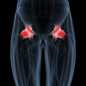 人体骨质联合疼痛解剖HipPain3图片