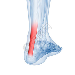 人体骨合体疼痛解剖Leg联合3图片