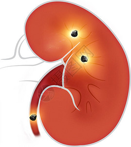 肾脏是脊椎动物体内发现的两个豆形器官肾图片