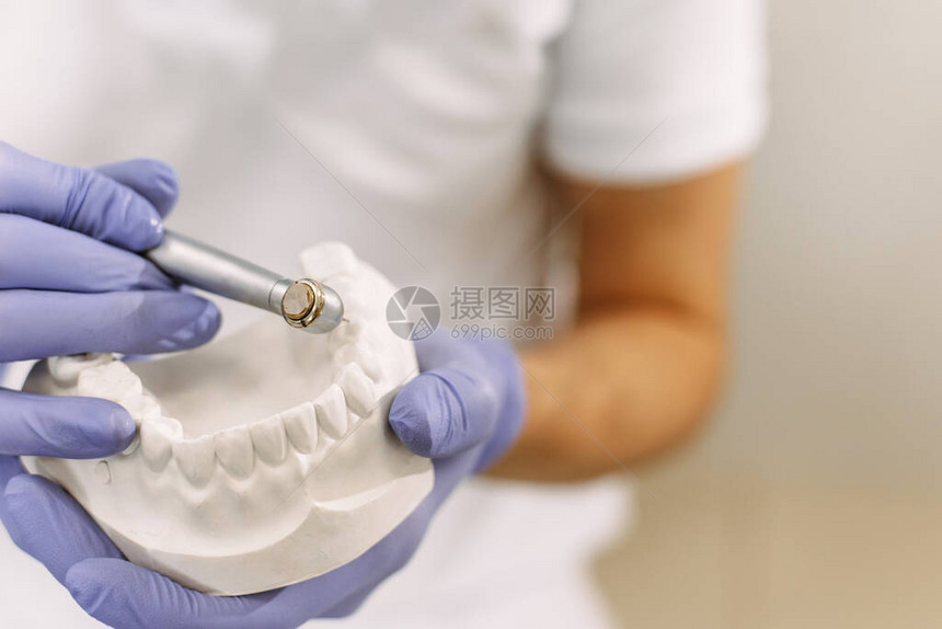 牙科诊所专业牙科诊所中带颌样品牙齿模型的集中牙医牙医拿着带有植入物图片