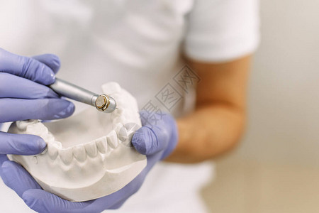 牙科诊所专业牙科诊所中带颌样品牙齿模型的集中牙医牙医拿着带有植入物图片