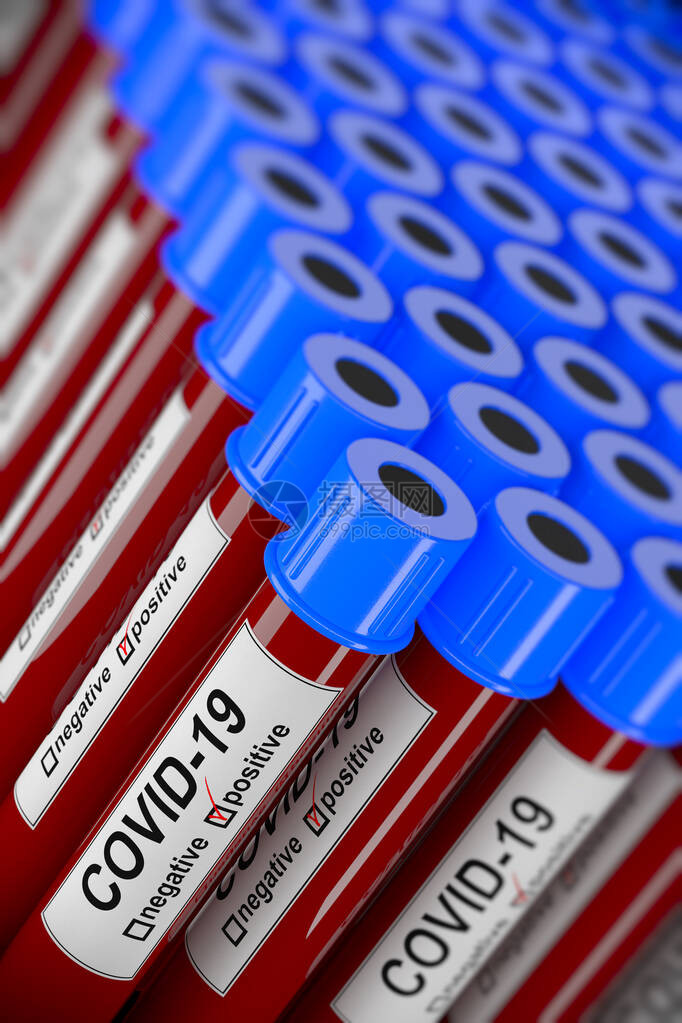 许多带有COVID19阳测试的血液试管的3D插图实验室血液检测样本的概念图片