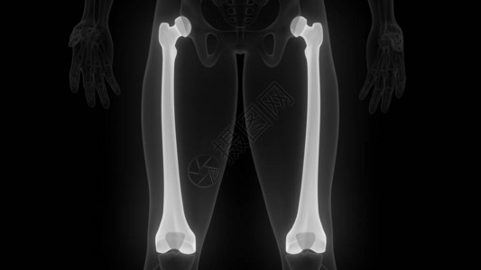 HumerusBone人类骨图片