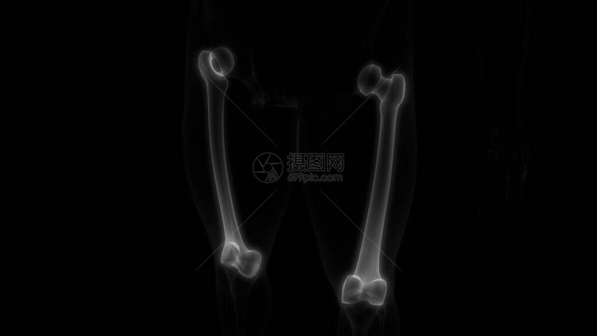 人体骨骼系统解剖3D转化的FemurB图片