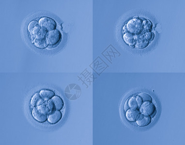 人工受精图片