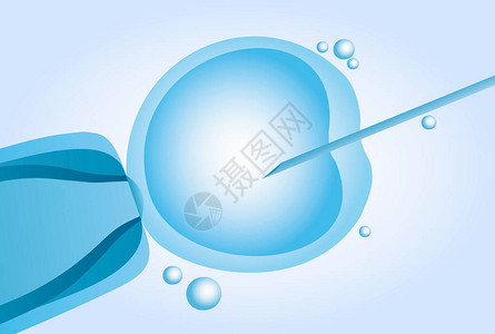 微型人工授精体外受精IV图片