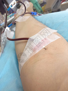 在输血时病人的手臂在医院内用针头将图片