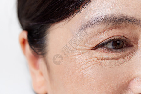 中老年女性眼角细纹特写图片