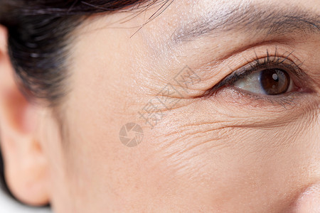 眼部除皱中年女性眼部特写背景