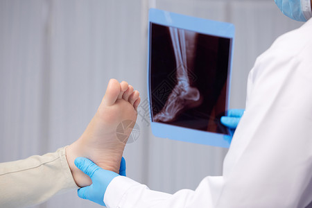 医生检查女性脚部x光片高清图片